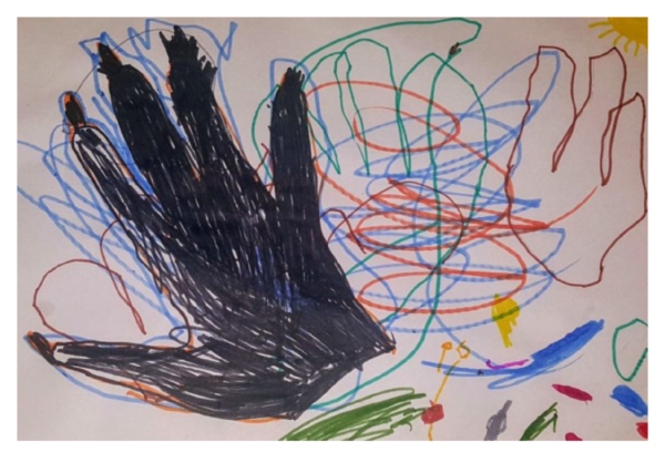 Pontus Skyttberg - 5yrs- Hand